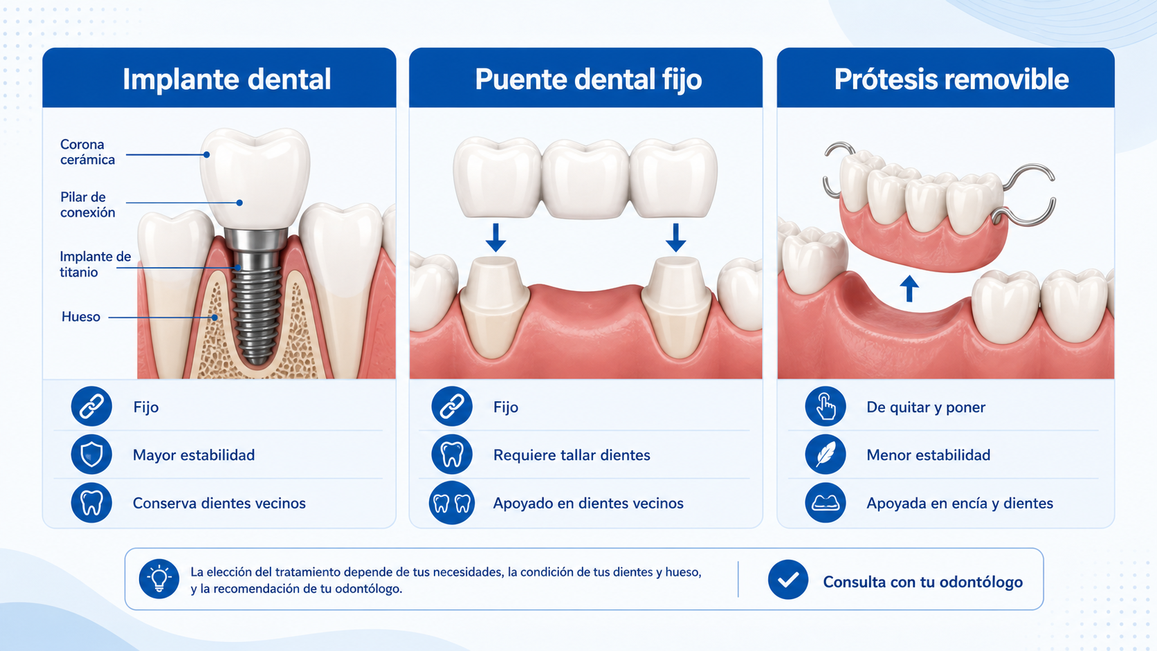 Esquema comparando implante dental, puente y prótesis removible